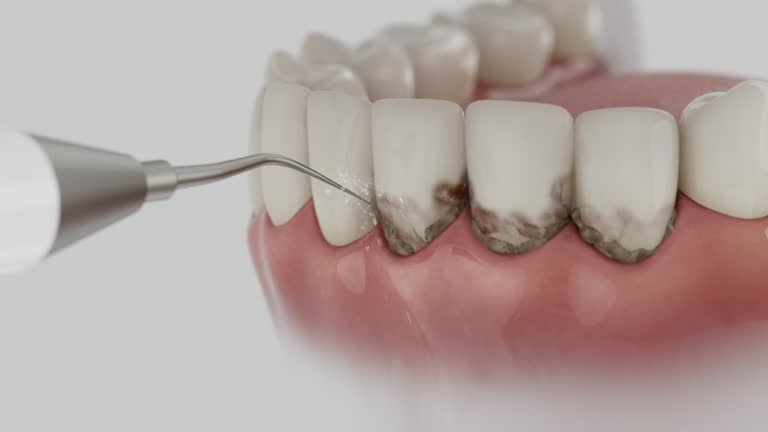 Trusted Root Canal Treatment service in Kettering, OH - Dentist Open Now